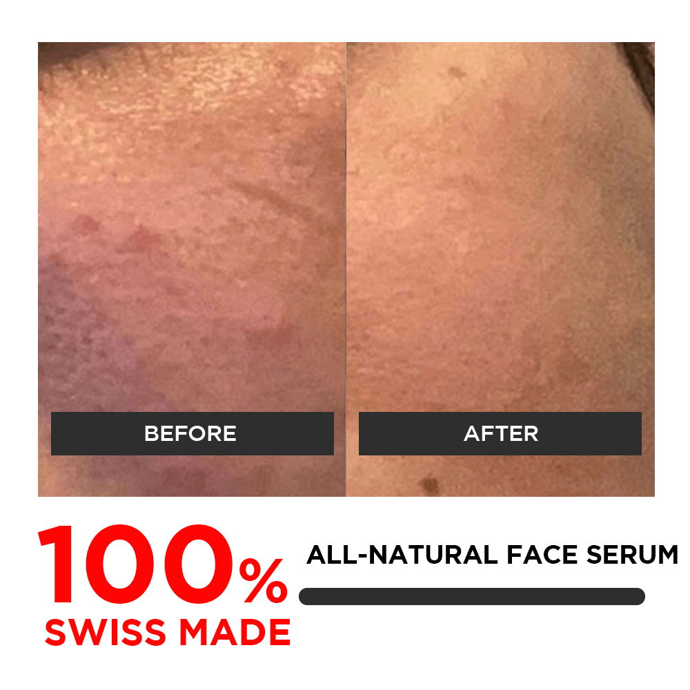 Skin Perfect Elixir Face Serum